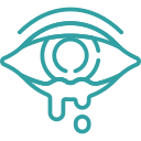 Watery Eye